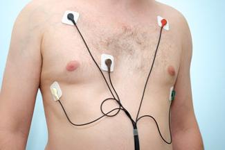 heart rhythm monitors: image of Holter monitor